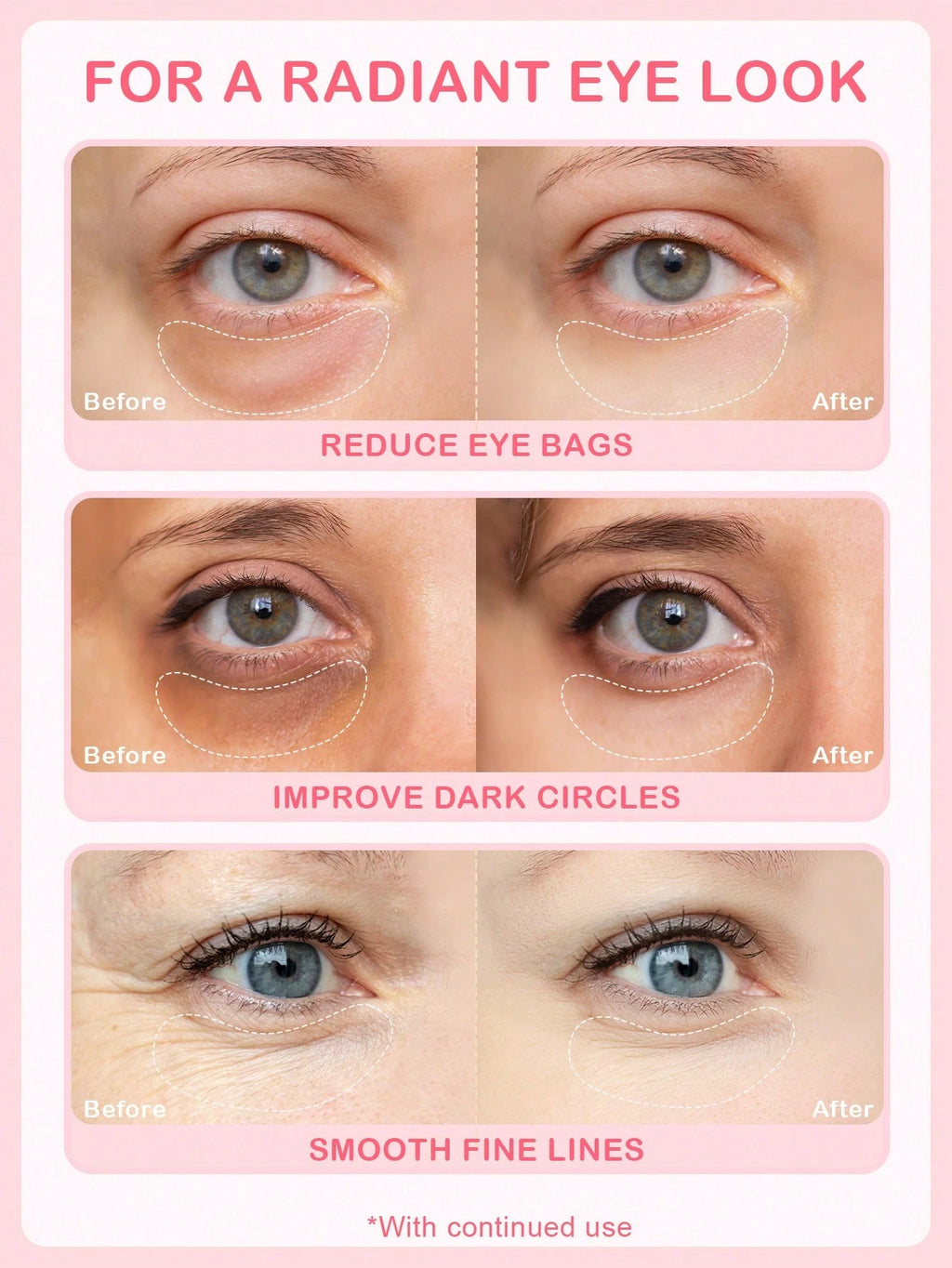 SlowSunday Rose Eye Mask | Luxurious Rose Scented Sleep Mask