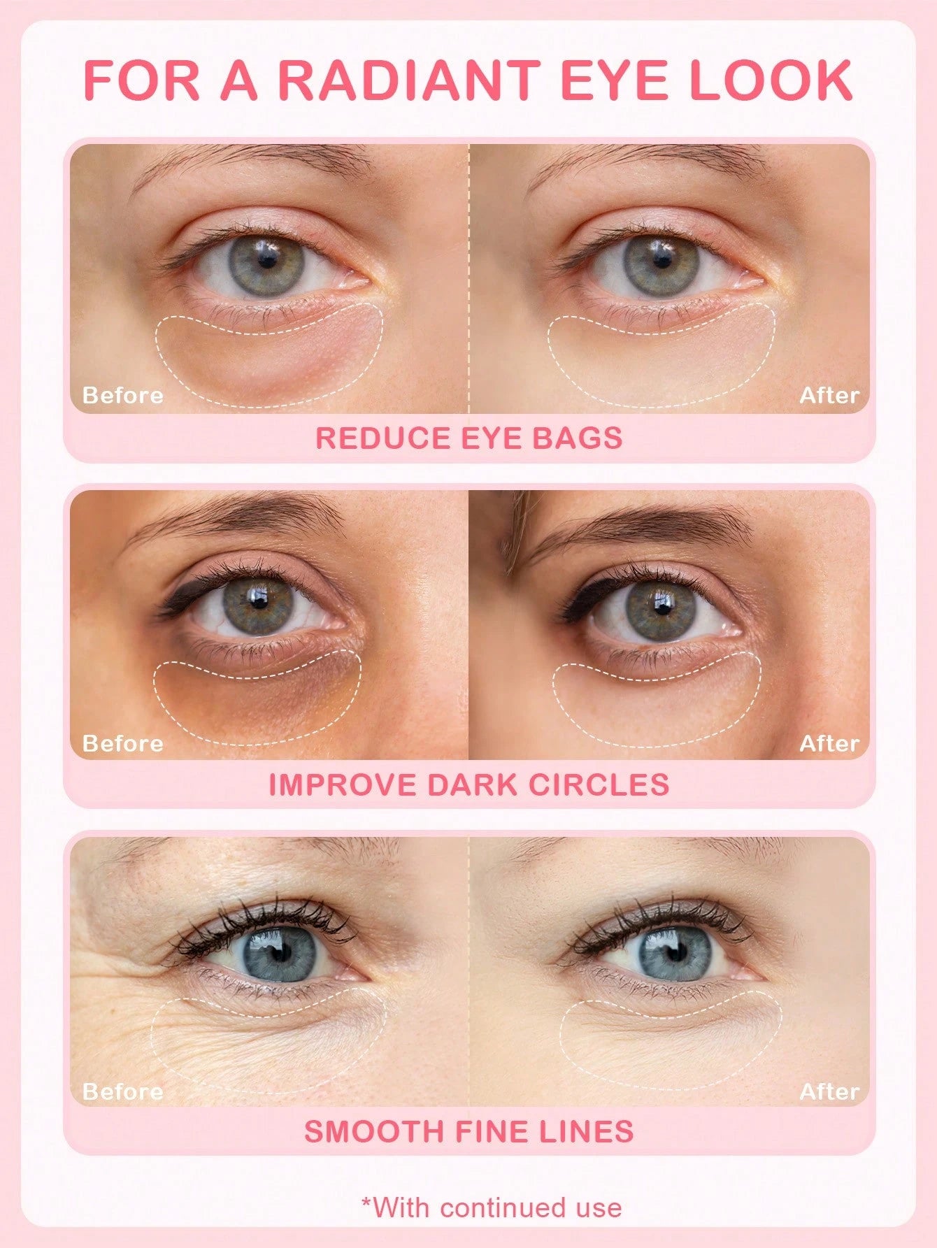 SlowSunday Rose Eye Mask | Luxurious Rose Scented Sleep Mask